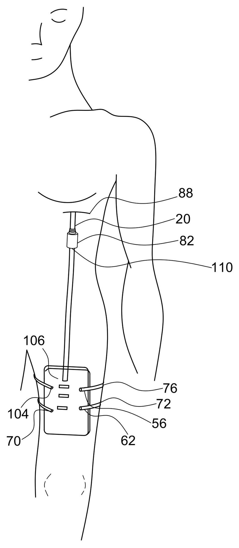 utility patent drawing sample 5